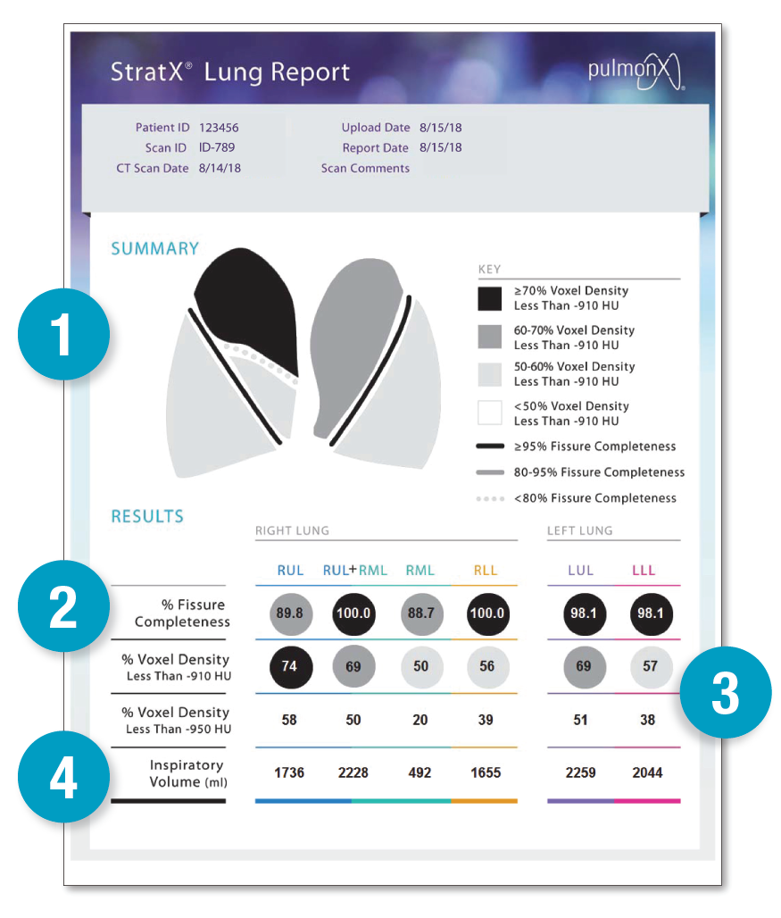 Pulmonx | StratX Lung Assessment for Emphysema Patients