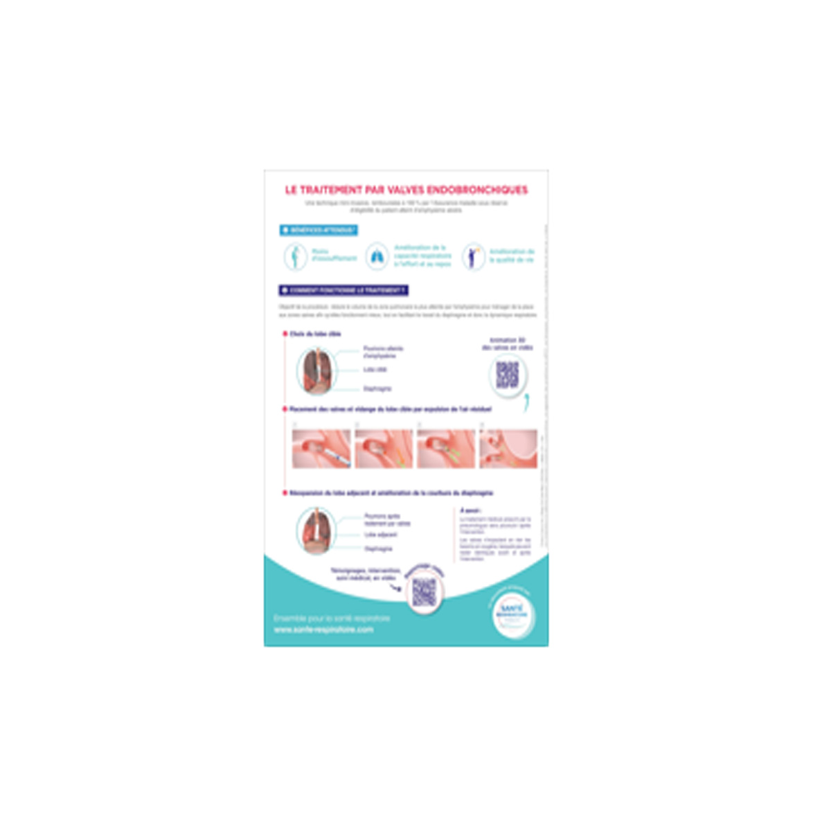 Fiche - Consultation pneumologue référent