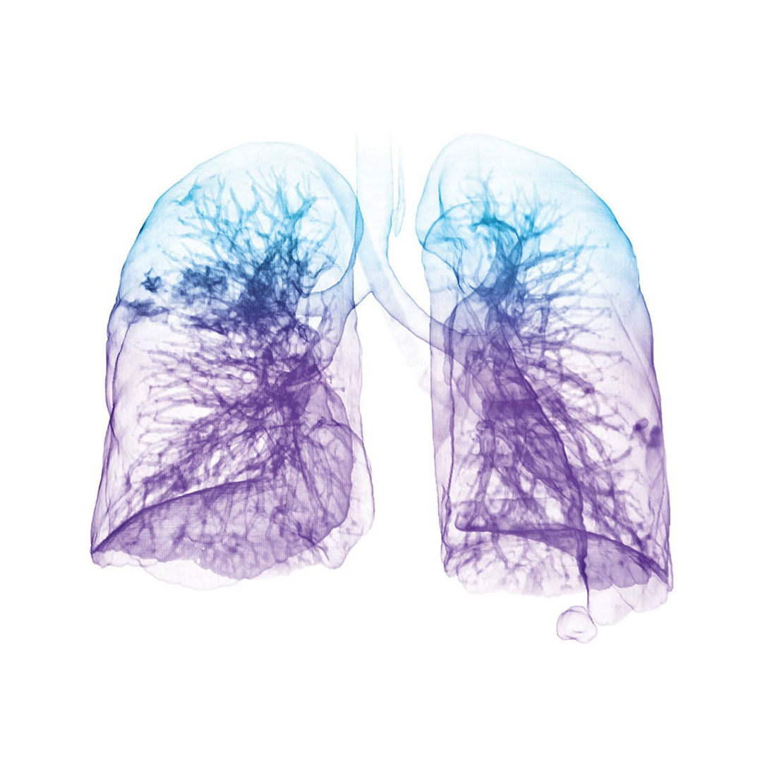Blue Green Lungs