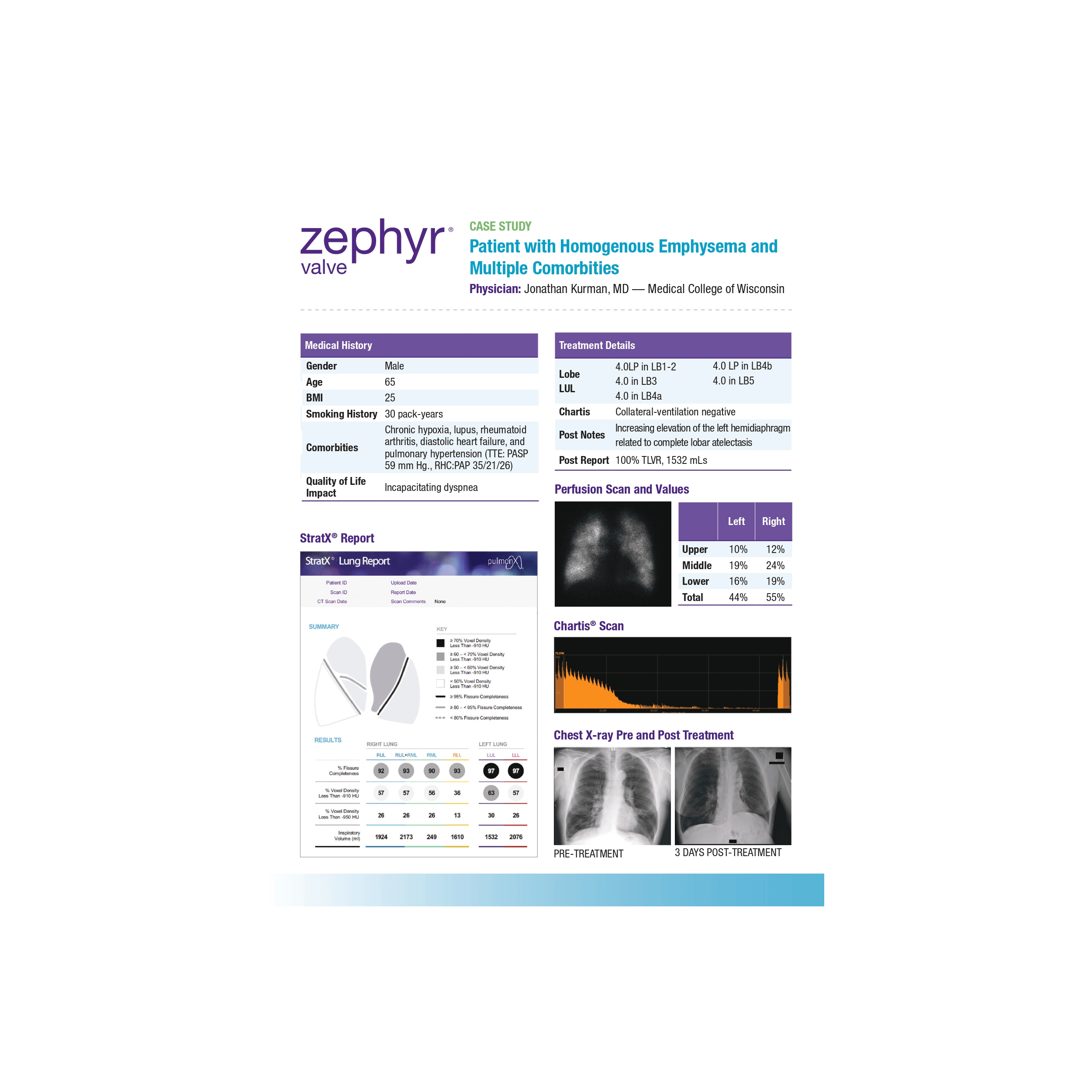 Patient with homogenous emphysema and multiple omorbities experiencing tremendous improvement in QoL_page-0001 (1)