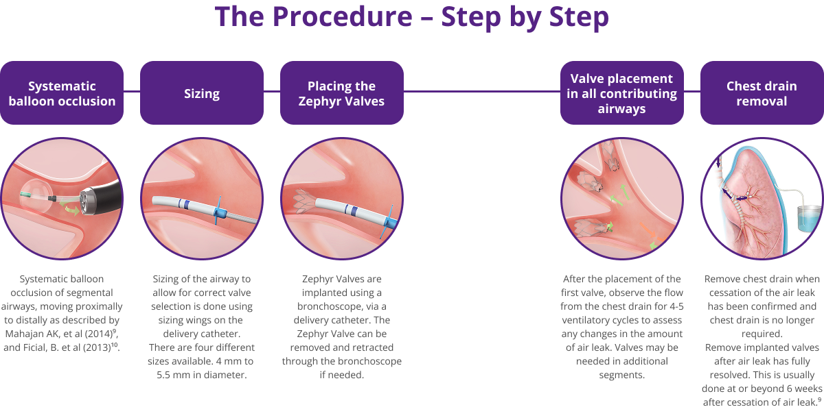 The Procedure