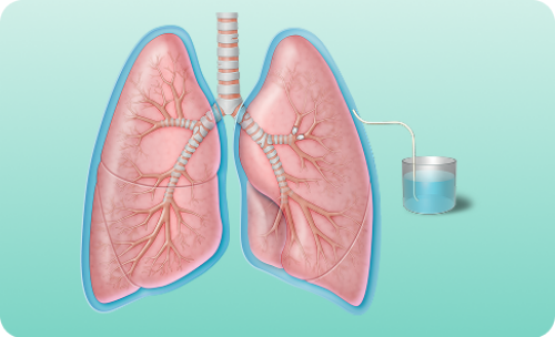 Lungs